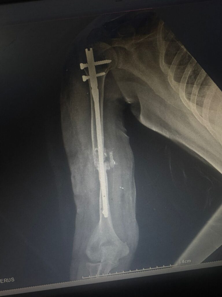 AasthaLok-Hospital-05