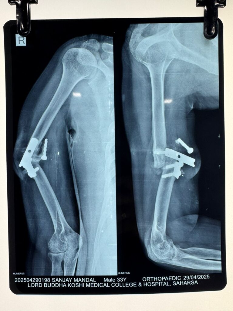 AasthaLok-Hospital-06