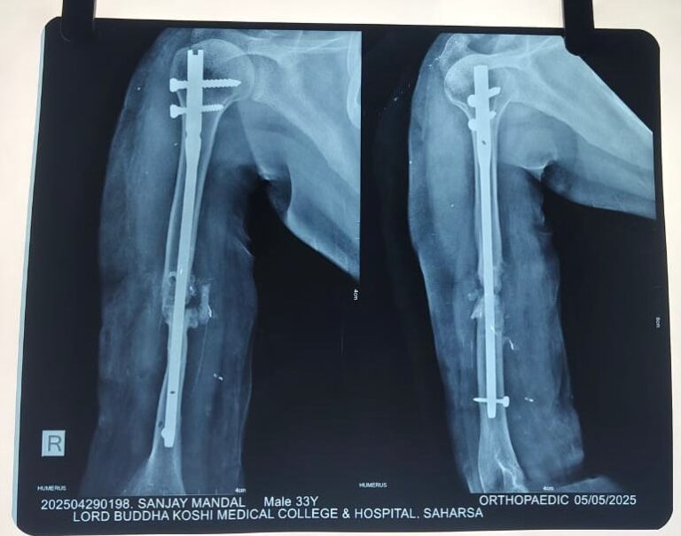 AasthaLok-Hospital-07