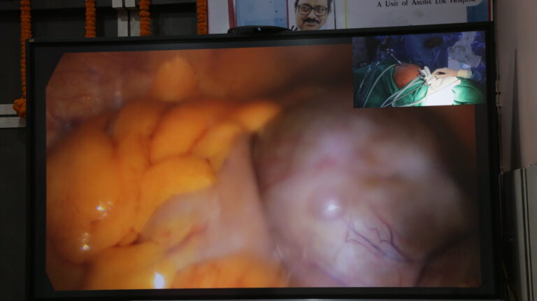 Laparoscopy-15-scaled