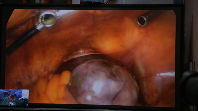 Laparoscopy-16-scaled