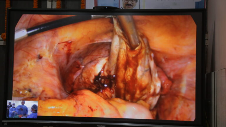 Laparoscopy-17-scaled